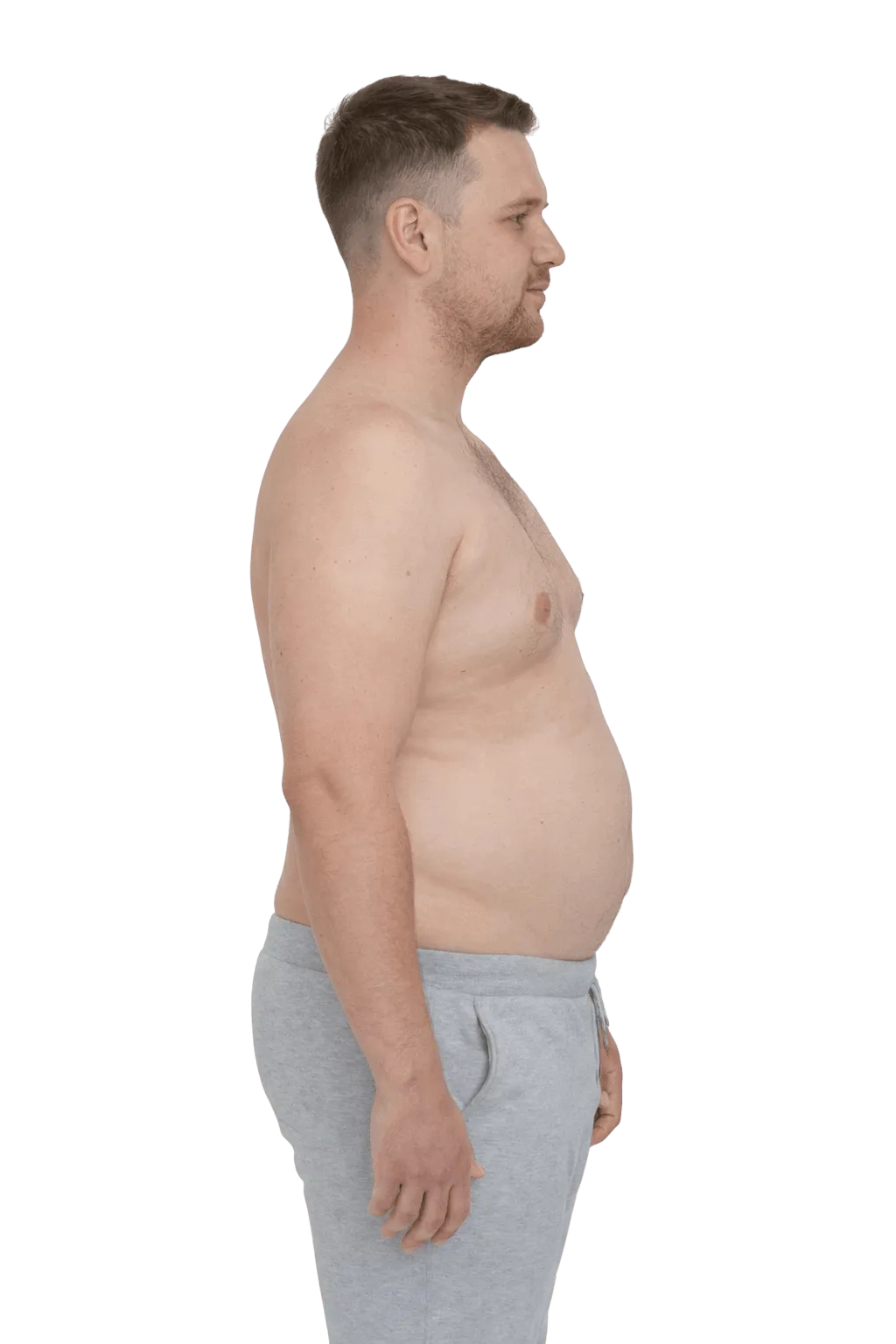 VEROSHAPE™ - Compression Tank